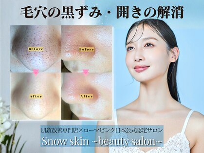 スノースキン(Snow skin)の写真