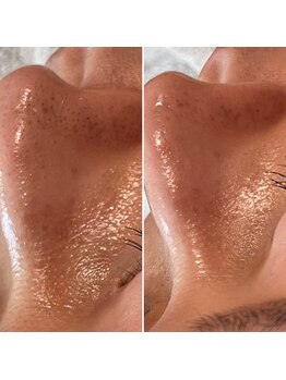 エステティックサロン S/毛穴ケア