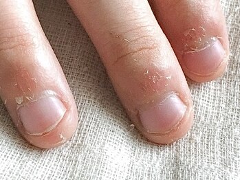 オープンセサミ 練馬/ジェル等で行う地爪育成