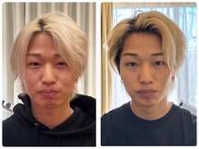 クランシュプール恵比寿鍼灸院/ビフォーアフター/3回の変化！