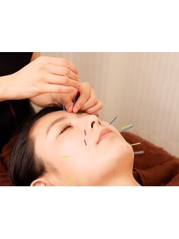 鍼灸施術を受けたい