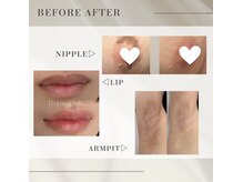 クリニカルボーテ 心斎橋院(CLINICAL BEAUTE)/ローマピンク