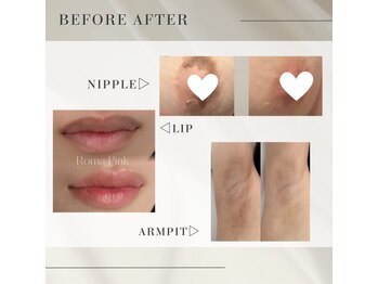 クリニカルボーテ 心斎橋院(CLINICAL BEAUTE)/ローマピンク