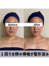 お顔の研究所/ビフォーアフター写真♪