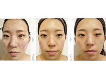 セラビシャン/before→after