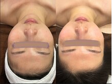 クレドペール(Eclat de Perles)/乾燥、赤み、くすみでお悩み