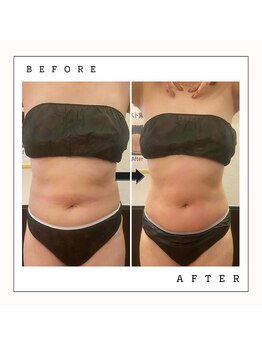 カピリナ(Kapilina)/ WINBACK回数券【30代後半女性】