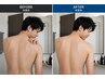 【メンズ背中ニキビケア】繰り返す背中ニキビに徹底ケア 
