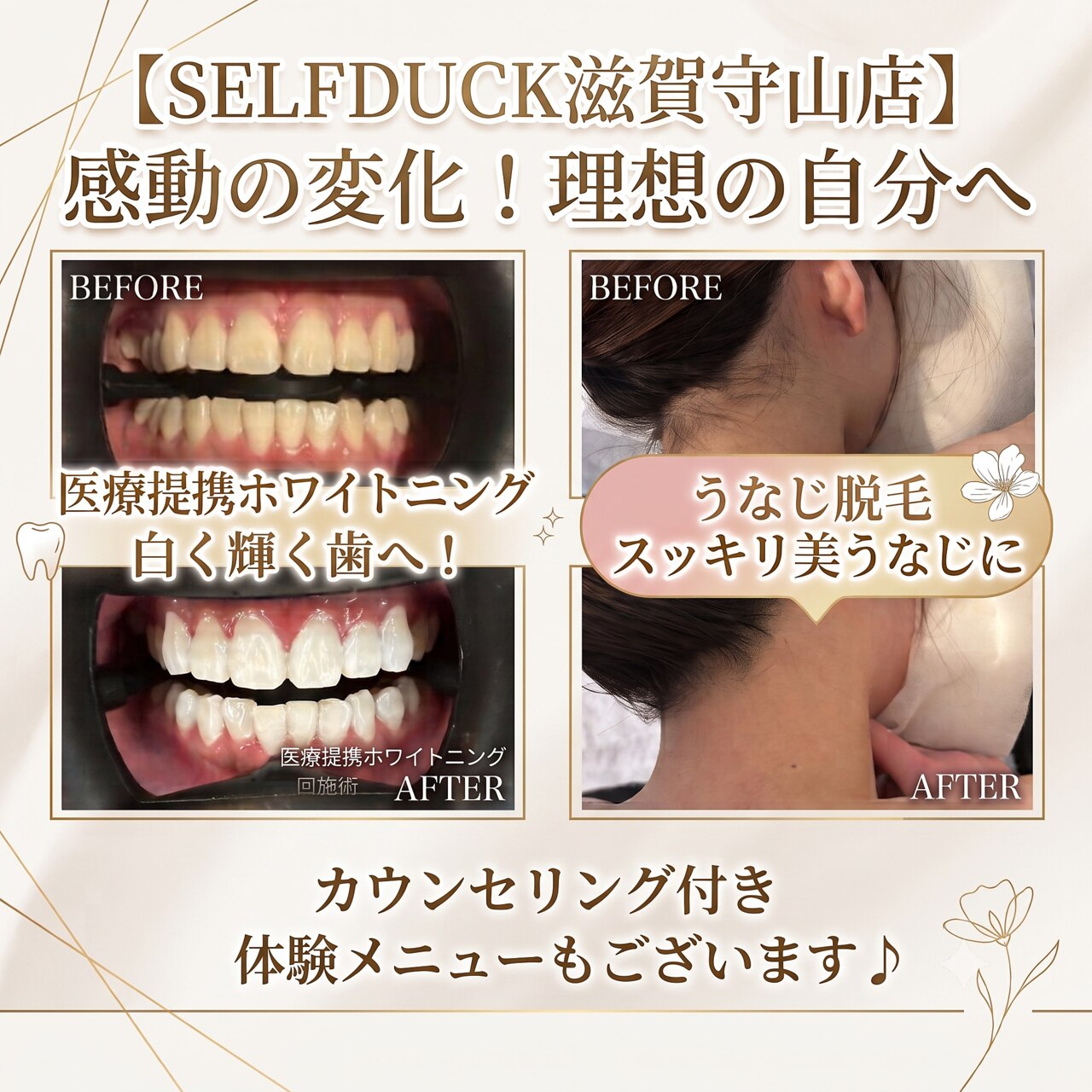 【医療提携】ホワイトニングメニュー導入　単品可 セルフダック 滋賀守山店(SELFDUCK)｜ホットペッパービューティー
