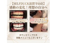 セルフダック 滋賀守山店(SELFDUCK)