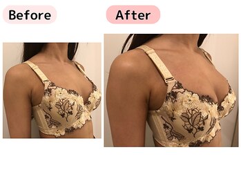 ピーグランディ 栄店(p-Grandi)/【お悩み】デコルテのボリューム