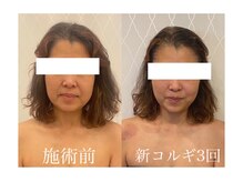 エイミー(Amy)/50代女性シワたるみに変化