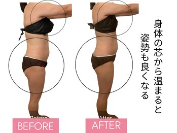 ヨサパーク ルアナ 高島店(YOSA PARK Luana)/こりも姿勢も温めれば変わる！