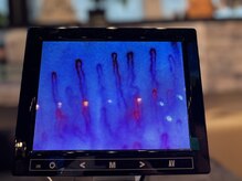 最終形美/少し糖質が多い状態の毛細血管