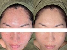 アモ 夢シティ新下関(AMO.)/セラピール