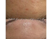ライリー(Rairy)