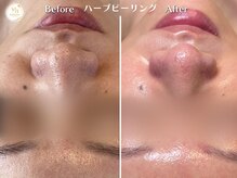プリュボーテ(Pul Beaute)/化粧ノリが良い滑らかな肌へ