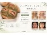 【顔】毛穴・ニキビに◎肌質改善ハーブピーリング｜4,400円のオプション付き
