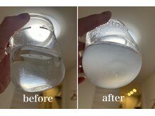 KMB 中崎町店/毛穴洗浄