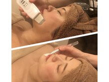 アイシア(Isia)/超音波毛穴洗浄/基本の前処置に