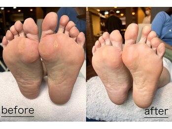 エクリュ(ecru)/角質ケア＋1カラー