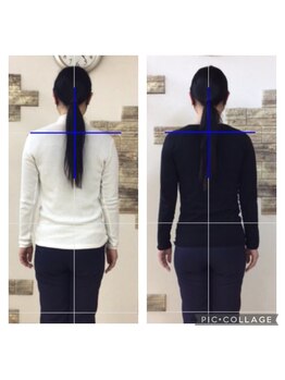 まほろば鍼灸整骨院 美骨痩身ベルナ(BELUNA)/美容整体でエイジングケア