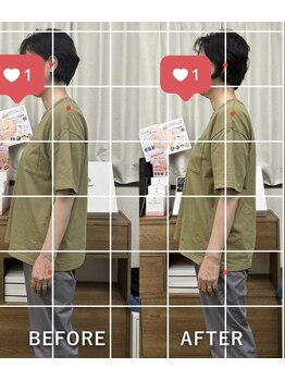 上六ミューク整体院/☆巻き肩ストレートネック改善☆