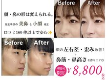 隆鼻矯正専門店 ラプリセレネ (Raplit Selene)