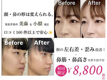 隆鼻矯正専門店 ラプリセレネ (Raplit Selene)