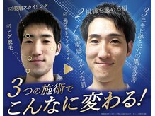 イデアル(IDEAL)