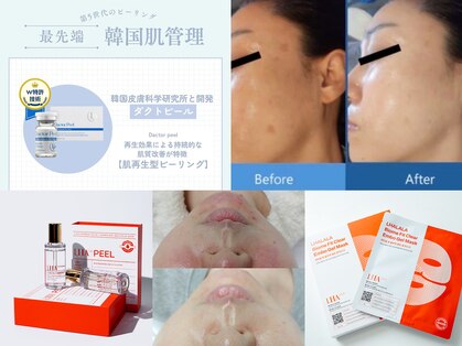 カラット(CARAT)の写真