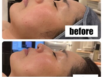 アモ 夢シティ新下関(AMO.)/セラピール