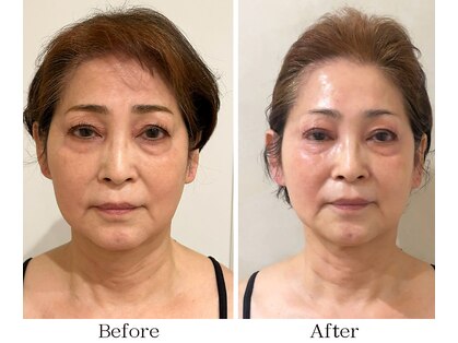 ドクターボディクリスタル(Dr.Body Crystal)の写真