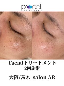 サロン アール(salon AR)/プロセルセラピーズフェイシャル