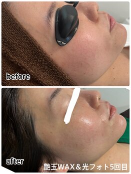 ケースタイル(k.style)/トーンアップ