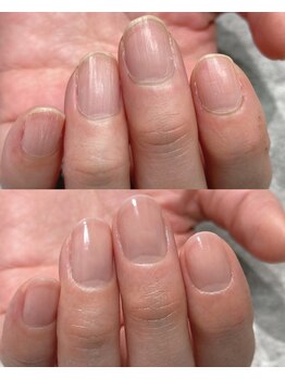 ミュー(mu.)の写真/お悩みを改善したい方向け爪育成！深爪や傷み爪も自爪育成で美しく☆全メニュー甘皮ケア付きで指先ケア♪