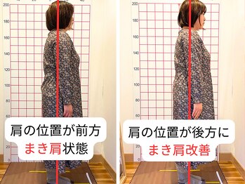 よしかわ整体院/肩こりまき肩猫背改善