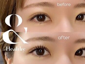 メエ(MEE)の写真/【大人気*アンドヘルシー(LEDフラットラッシュ80本+まつげパーマ)】ぱっちり可愛いを求める欲張り女子に♪