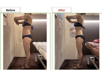 エステティック レイビス 銀座店(RAYVIS)/