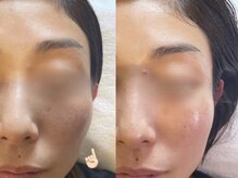 アモ 夢シティ新下関(AMO.)/セラピール