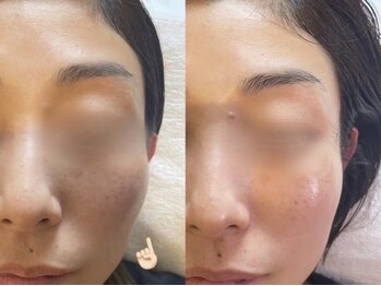 アモ 夢シティ新下関(AMO.)/セラピール