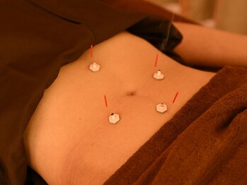 ハリ是好日の写真/溜め込み体質を卒業!鍼×よもぎ蒸しの相乗効果で、冷え・むくみを解消して健康的な身体づくり◎