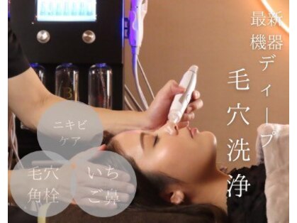 カームアライン(CALM ALIGN)の写真