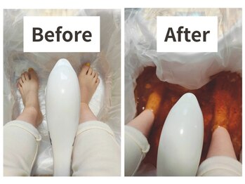 スマイルエム(SmileM)の写真/冷え改善！足元から化学物質等の排出サポート◎身体が温まり、軽くなるのを実感♪
