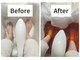 スマイルエム(SmileM)の写真/冷え改善！足元から化学物質等の排出サポート◎身体が温まり、軽くなるのを実感♪