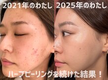 ウル 下北沢(Ulu)の雰囲気(オ-ナ-自身も肌荒れ経験者です!お悩みに寄り添い改善致します!)