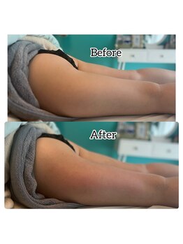 トータルビューティーアンドウィズ(total beauty&WITH)/【スリムムーブ下半身】むくみ脚