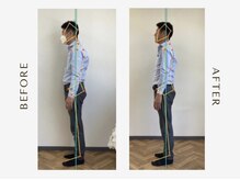 つむぎ鍼灸整骨院の雰囲気（姿勢矯正）