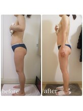 加圧ビューティーサロン スタイル エム(beauty salon style M)/30代/加圧×痩身リンパ120分