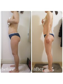 加圧ビューティーサロン スタイル エム(beauty salon style M)/30代/加圧×痩身リンパ120分